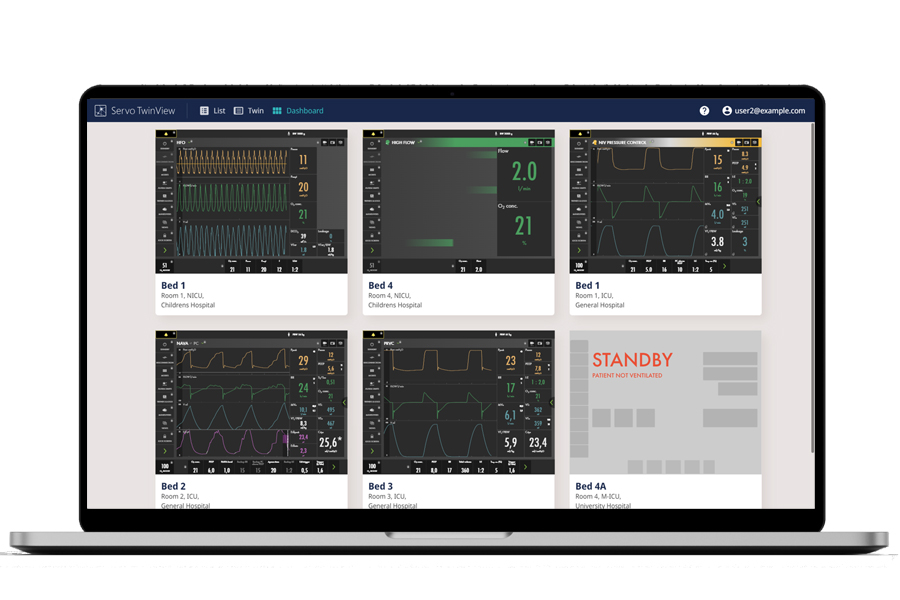 Laptop screen displaying Servo ventilator Dashboard View of remote virtual TwinView app