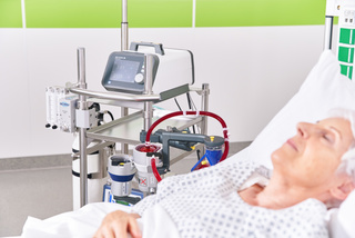 Ältere Patientin auf der Intensivstation mit einem ECMO-System zur extrakorporalen Membranoxygenierung am Krankenbett.