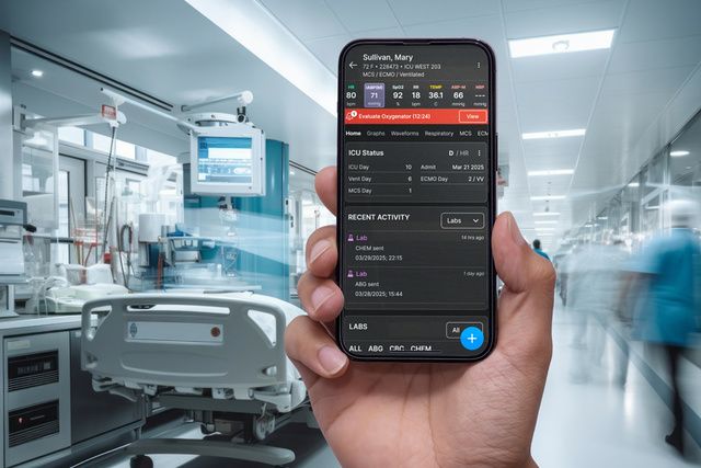 Hand with Talis ECMO with +ACG device in hospital wing