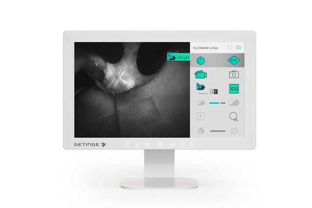 Fluobeam-LX-Red-perfusion-assessment