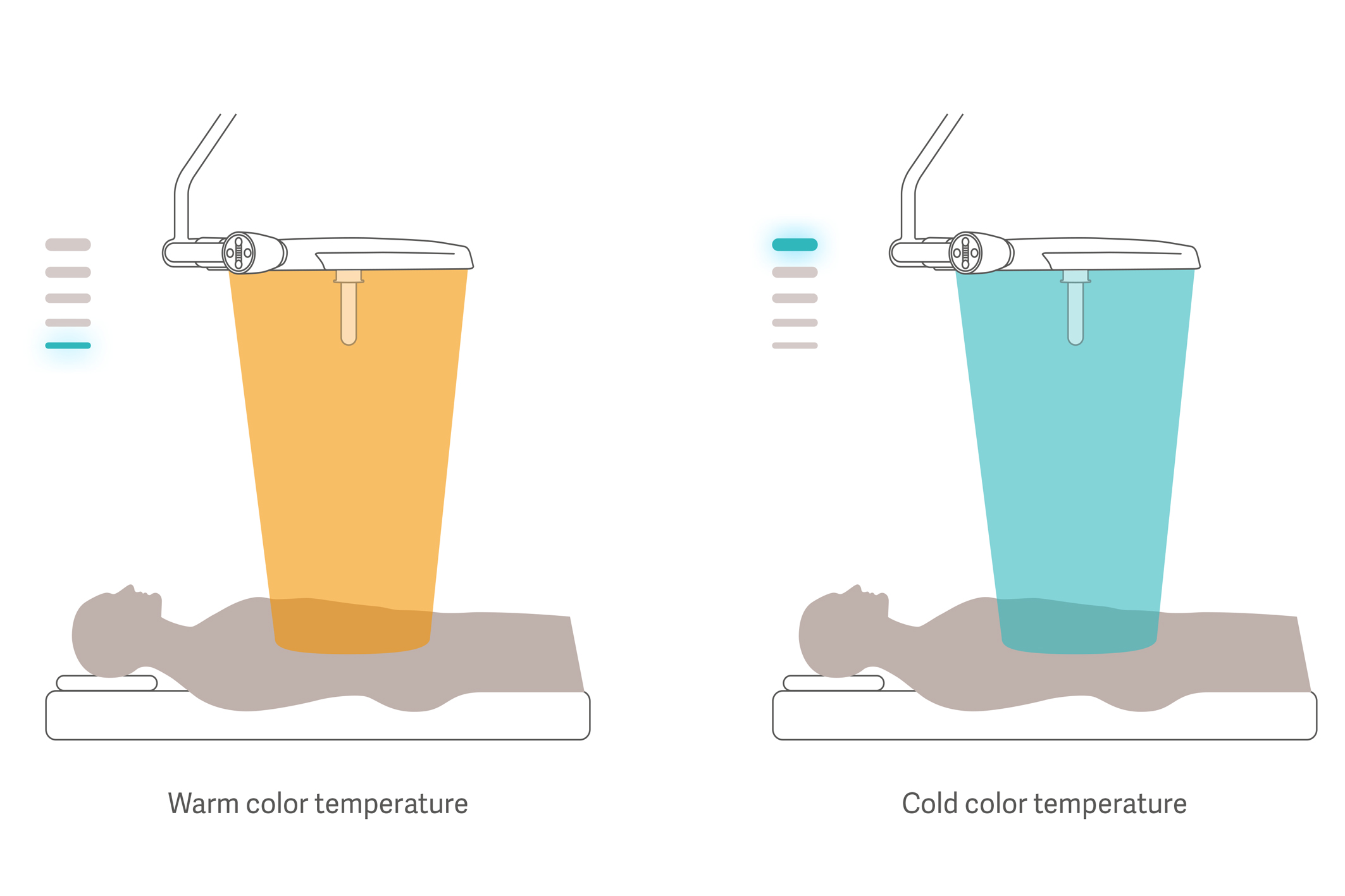 Drawing of Maquet Ezea surgical light adjustable color temperatures