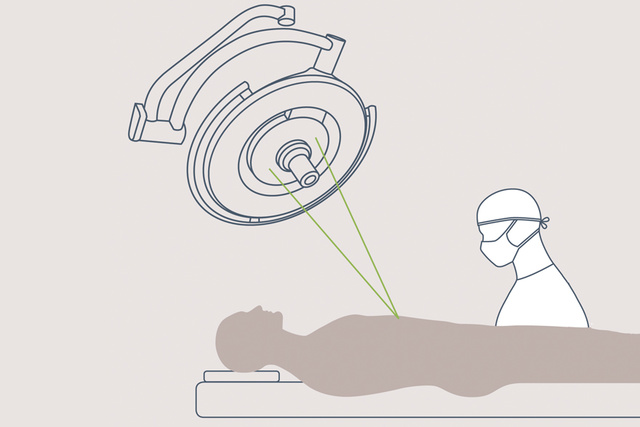 Maquet PowerLED II surgical light laser positioning guide