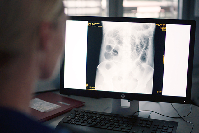 Staff watching at a xray image on a monitor in the office