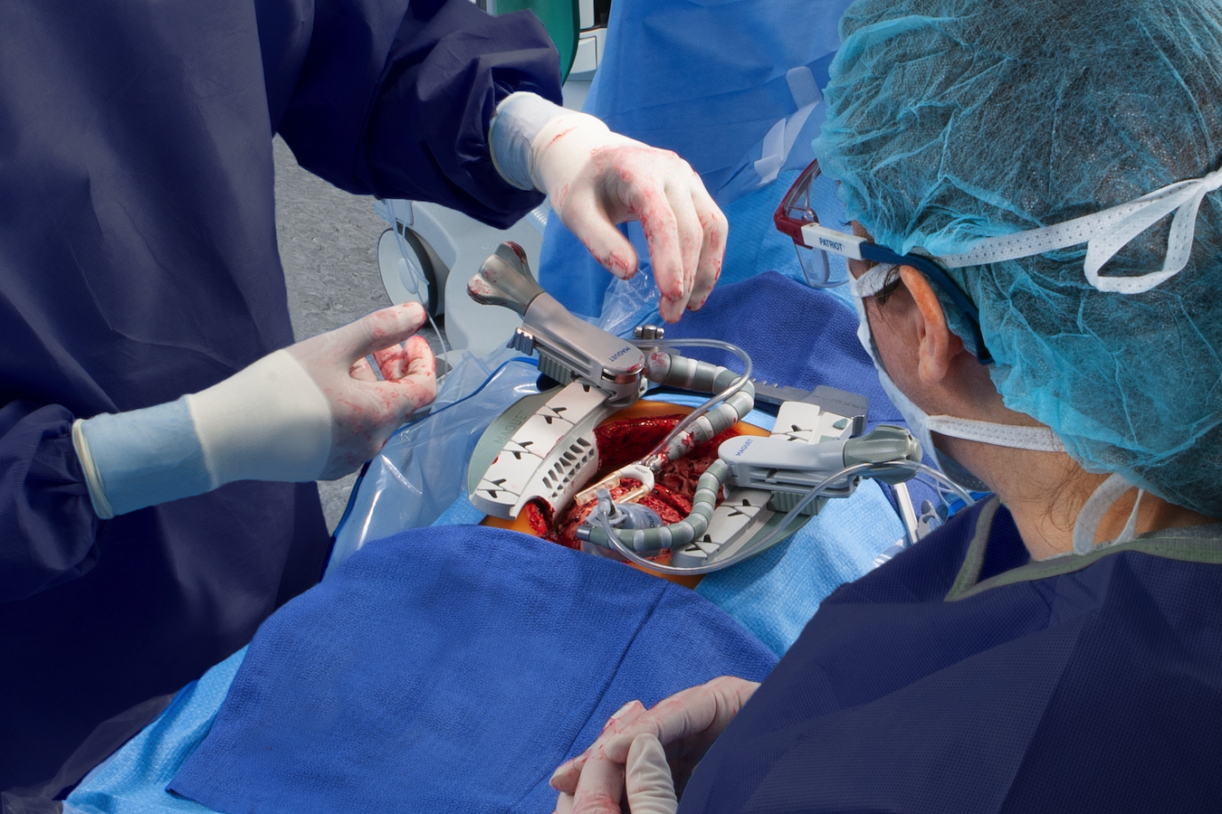 Beating heart surgery Beating heart surgery