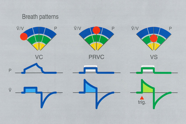 Graphic illustration depicting PRVC and VS Volume-targeted Ventilation breath patterns